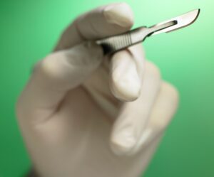 scalpel-vasectomy-can-cause-more-pain